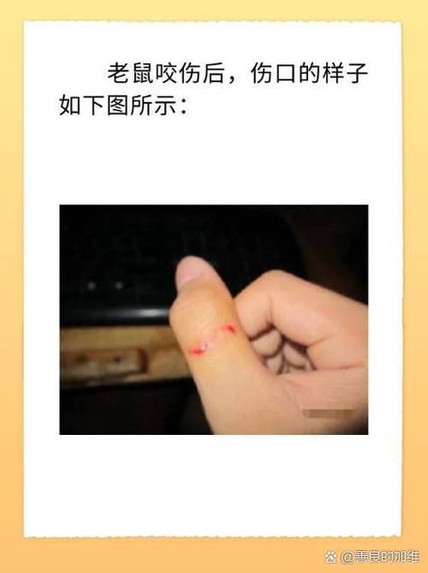 被仓鼠咬伤后的伤口处理方法缩略图
