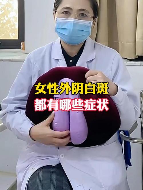 妇科白斑病是一种什么病怎样治疗图标