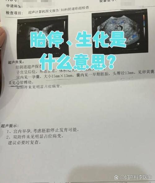 怀孕生化啥意思图标
