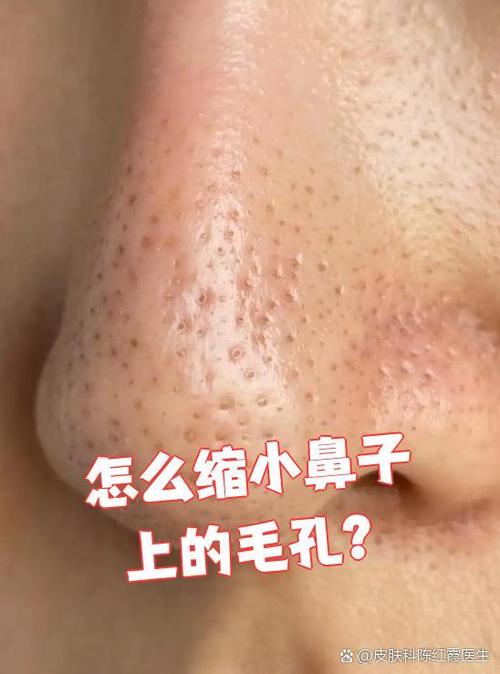 怎么缩小毛孔让皮肤细腻图标