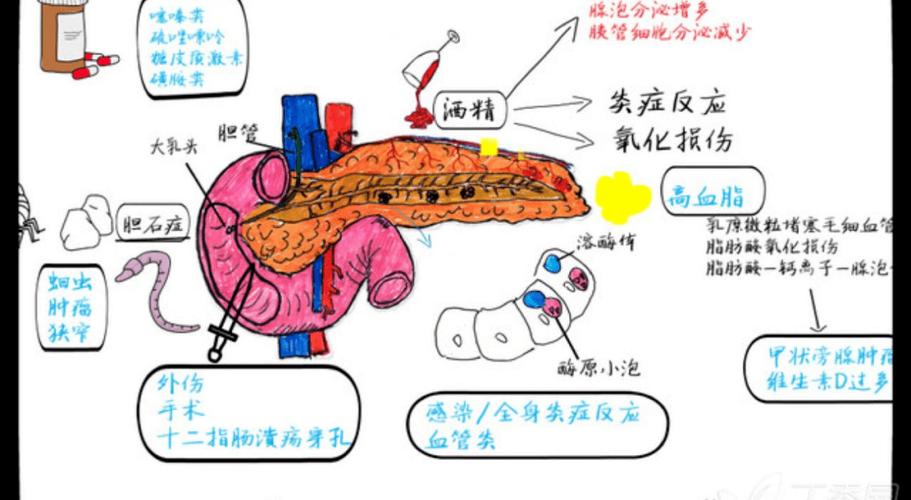 胰腺炎是被气出来的吗缩略图