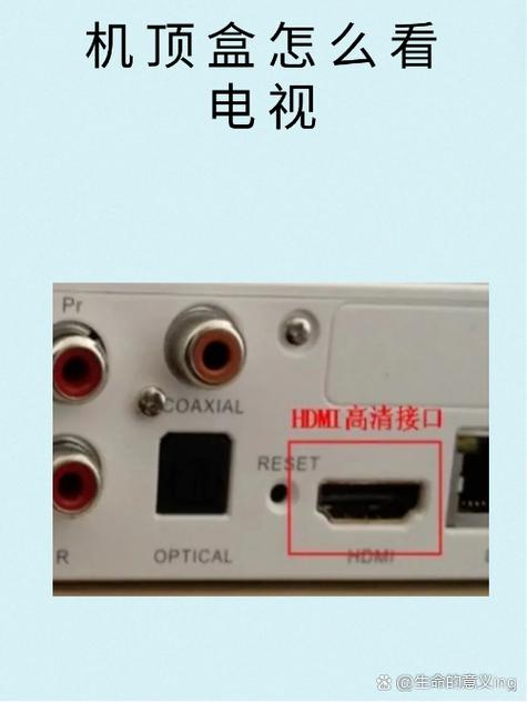 宽带如何连接电视机看电视缩略图