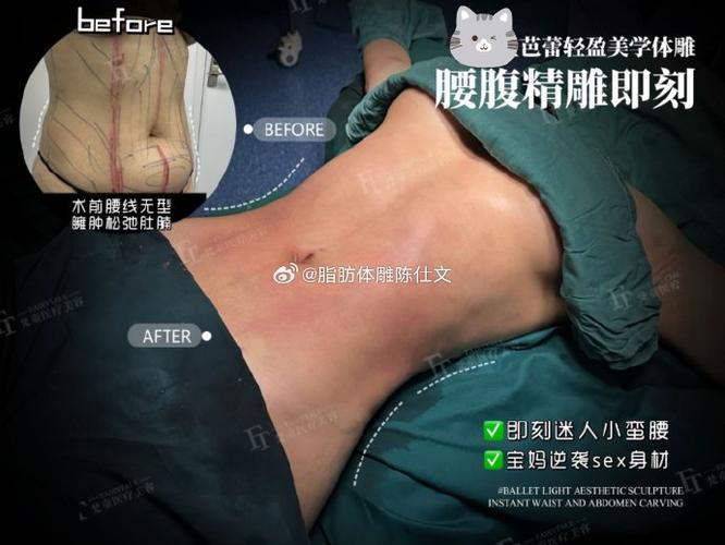 即刻运动减脂效果图标