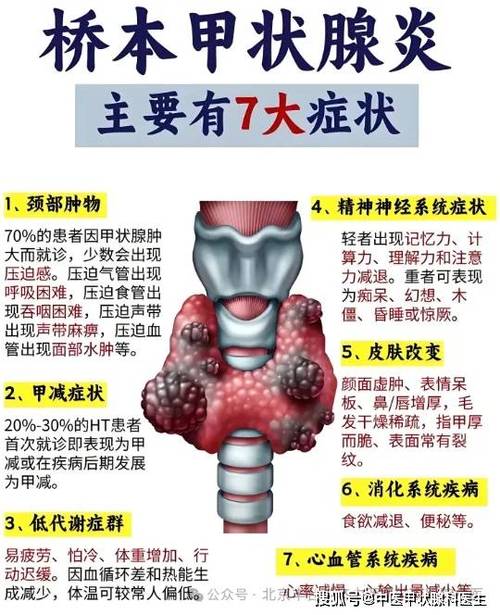 桥本病有什么症状图标