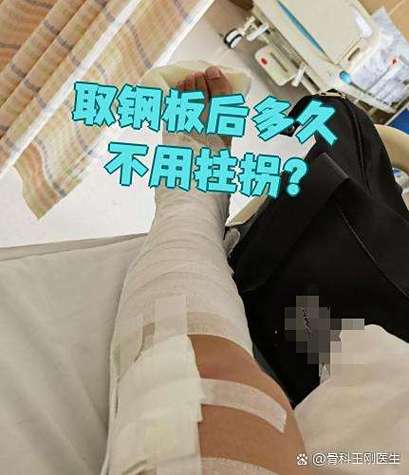 取完钢板可以不拄拐吗图标