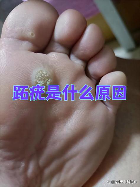 病毒能在鞋子上存活吗图标
