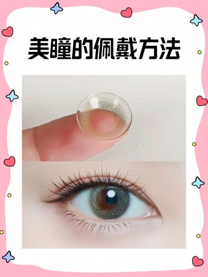 眼科检查可以带美瞳吗缩略图