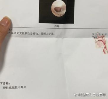 脑呜呜响是什么原因引起的缩略图