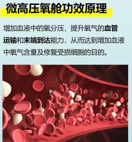 高压氧舱的好处和坏处缩略图