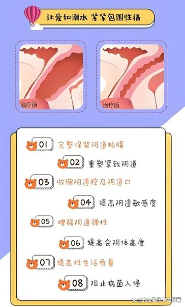 做紧缩手术的好处和坏处缩略图
