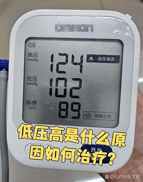 血压高低压是什么意思图标