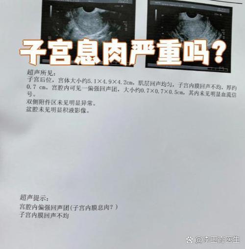 子宫息肉严重吗图标