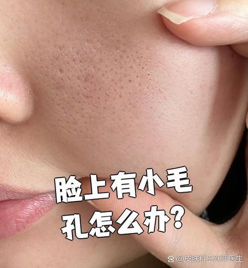 如何让毛孔变小皮肤细腻图标