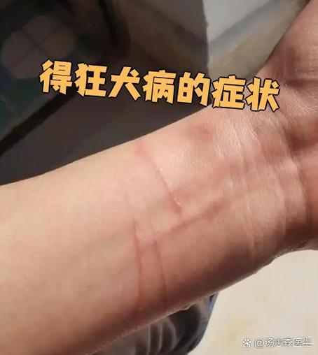 患上狂犬病有什么症状图标