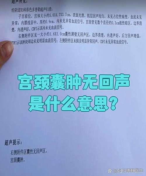 妇科检查有囊肿是什么意思缩略图