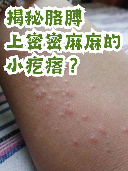 胳膊很痒一抓就出现好多小疙瘩图标