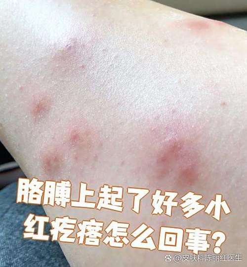 胳膊痒痒越抓越痒有小红疙瘩图标
