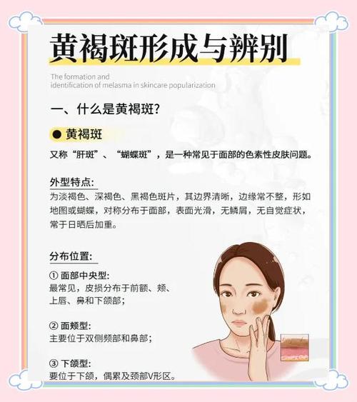 黄褐斑雀斑怎样才能彻底的去掉缩略图