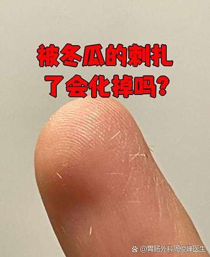 小冬瓜皮上为什么有刺刺的缩略图