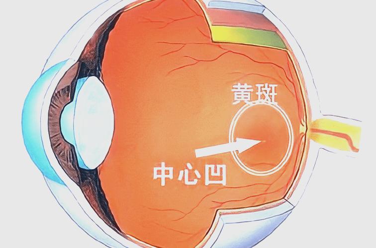 黄斑病变的早期症状怎么治疗图标