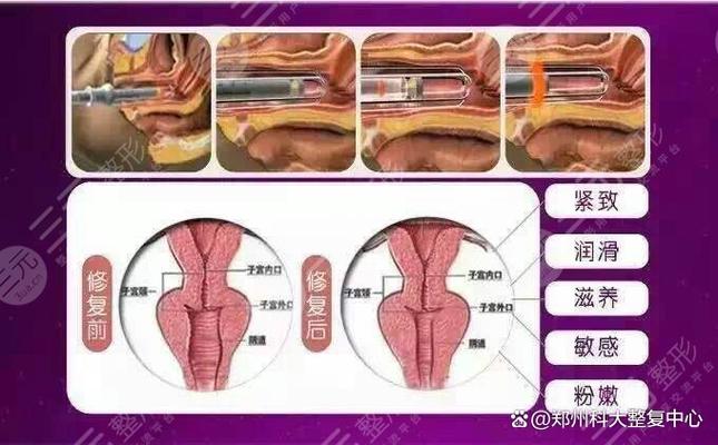 女人做紧缩手术有什么坏处游戏截图
