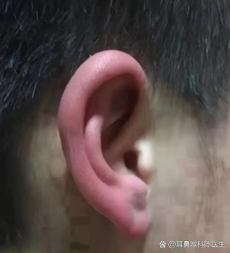 耳朵怎么通过揉变大图标