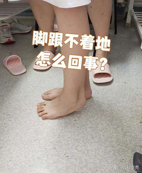 孩子走路脚跟不着地是怎么回事缩略图